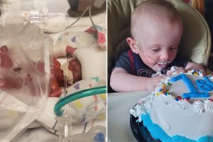 Bebé 'mais prematuro do mundo' celebrou o seu primeiro aniversário