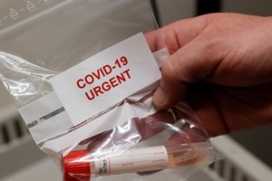 Covid-19: Portugal com mais dois mortos e 599 novos casos