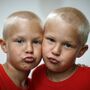 Gémeos têm modificações no ADN que mais ninguém tem