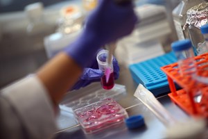 Tratamento desenvolvido em Espanha inibe crescimento de tumores