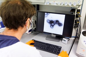 Já foram detetados mais de 300 casos de monkeypox em Portugal