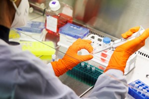 Novo surto de monkeypox com 37 casos em Lisboa e Vale do Tejo