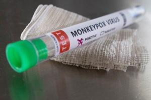 Monkeypox: cientistas estudam possíveis mutações genéticas e transmissão pelo sémen