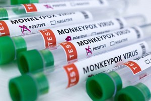 Monkeypox: há razões para estarmos preocupados? 