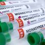 Monkeypox: há razões para estarmos preocupados? 