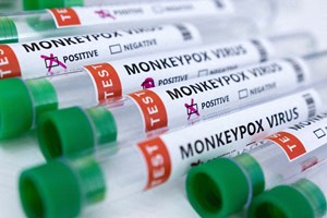 China aconselha a não tocar em estrangeiros após primeiro caso de Monkeypox
