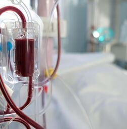 Estudo revela que doses personalizadas de hemodiálise aumentam sobrevivência dos doentes