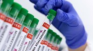 <![CDATA[ Mpox: Portugal é o sexto na Europa com mais casos entre 2022-2025  ]]>