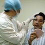Transplantes faciais 'melhoram vidas, mas não as salvam'