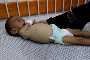 “Não consigo dar-lhe nada”: não há comida, as mães não têm leite e os bebés estão a morrer de fome em Gaza