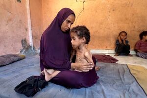 “Com demasiada fome, as crianças não conseguem chorar”: Médica relata situação trágica em Gaza  
