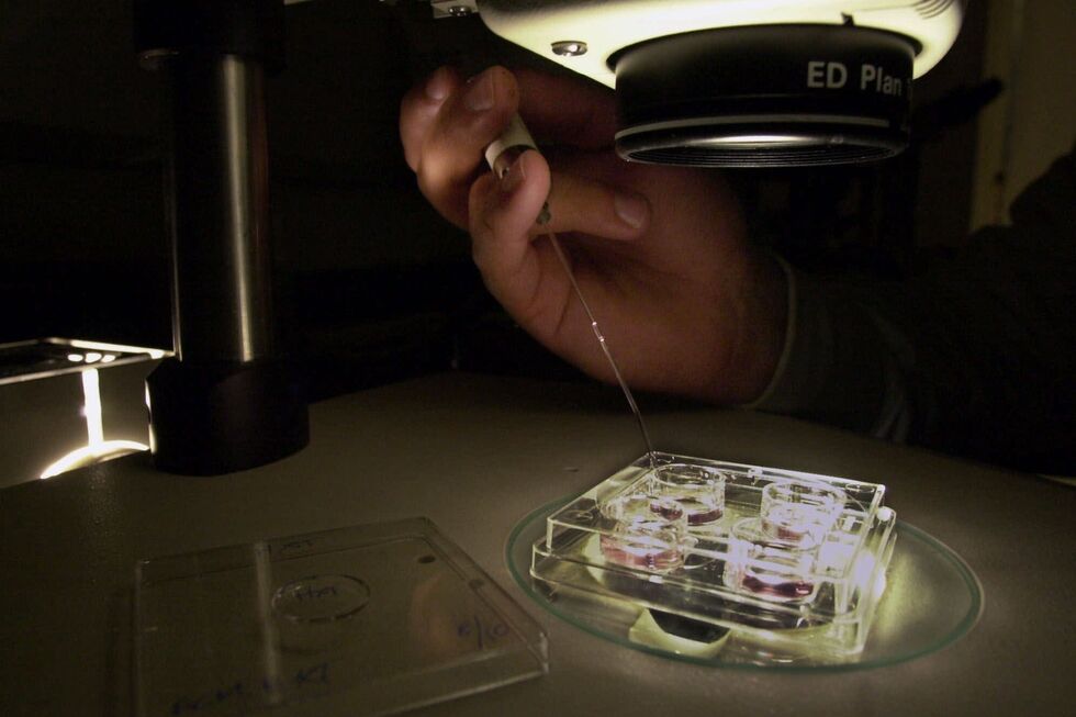 Células da pele transformadas em óvulos para fertilização in vitro