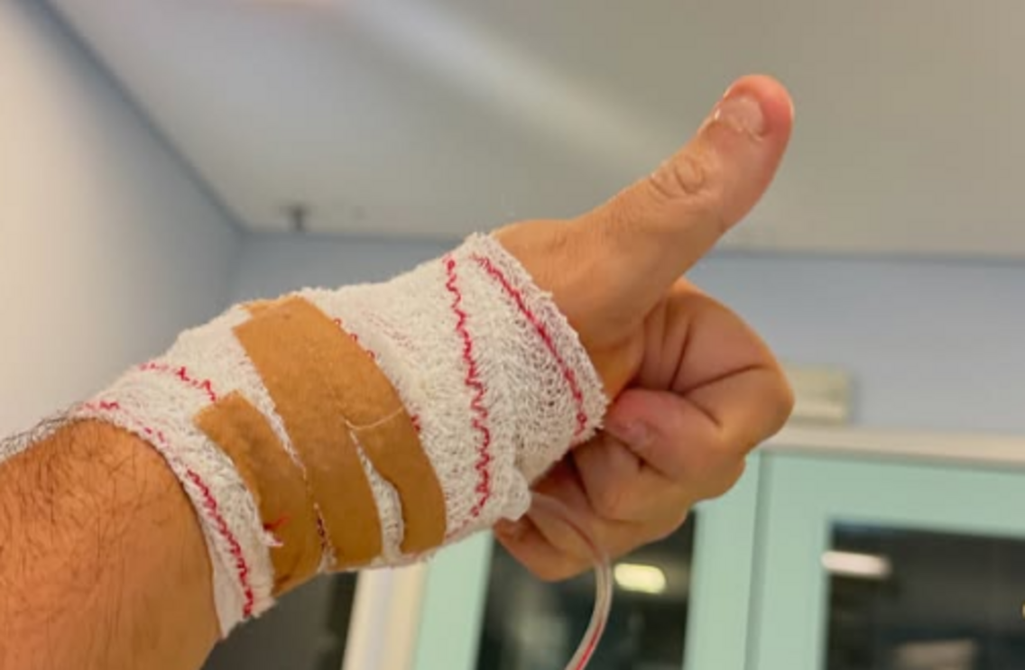 Nuno Markl mostra-se feliz por conseguir levantar o braço esquerdo