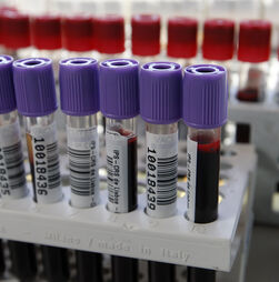 Portugal perde quase 10 mil dadores de sangue desde 2017 e regressa a níveis pré-pandemia