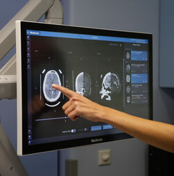 Mapeamento detalhado do cérebro pode permitir perceber a origem de transtornos psicológicos e doenças mentais