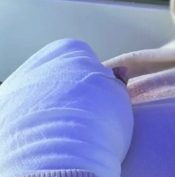 Agrupamento de Escolas de Souselo em Cinfães investiga amputação de dedos de aluno