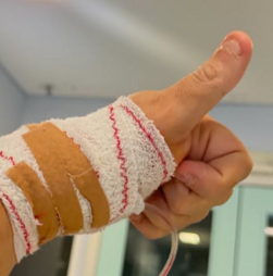 Nuno Markl mostra 'pequena grande vitória' na recuperação após sofrer AVC