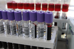 Portugal regista menos dadores de sangue e volta a níveis pré-pandemia, segundo o IPST