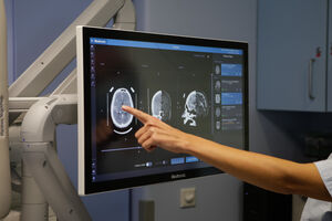 Cientistas criam mapa do desenvolvimento do cérebro para entender distúrbios