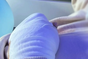 Aluno perde dedos em escola de Cinfães; direção investiga o caso