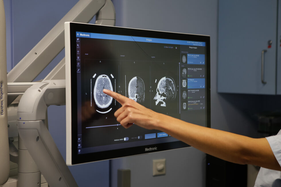 Cientistas criam mapa do desenvolvimento do cérebro para entender distúrbios