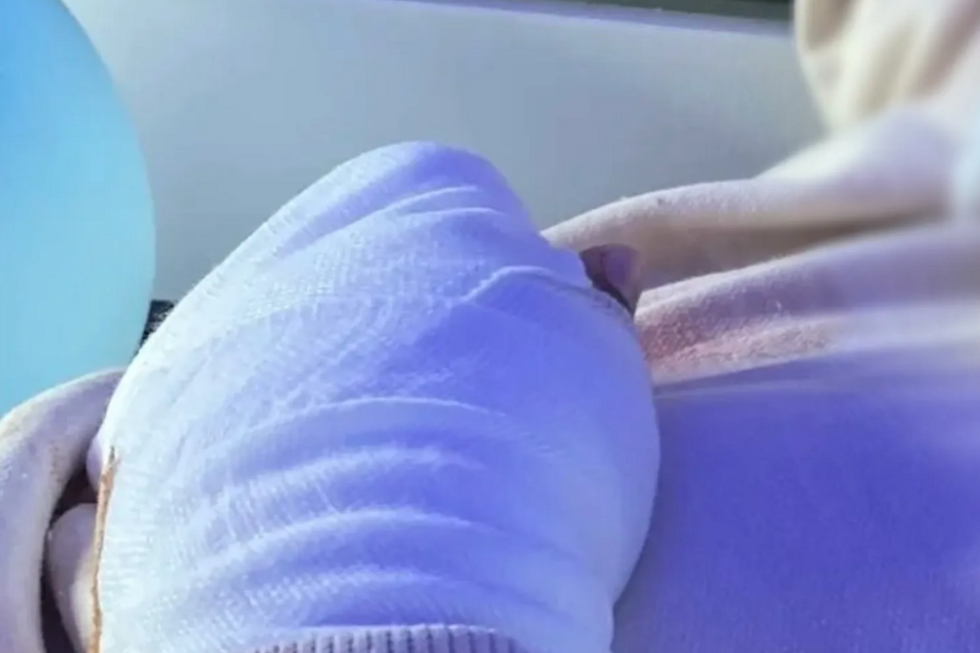 Aluno perde dedos em escola de Cinfães; direção investiga o caso