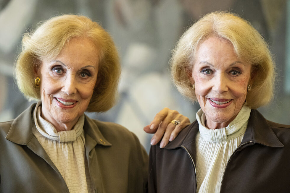 As irmãs Kessler atuaram como dupla, enquanto cantoras, bailarinas e atrizes, ao longo de décadas