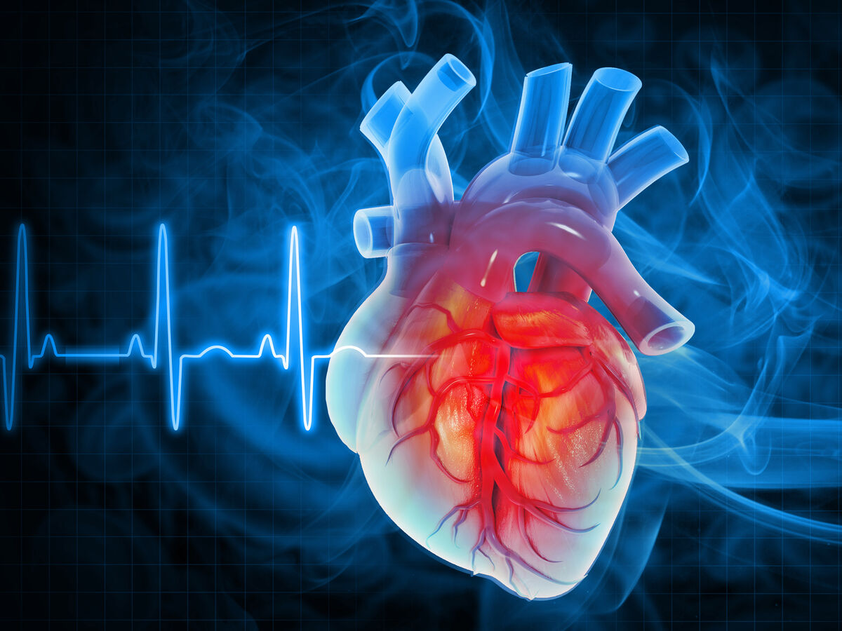 Como se recupera de um AVC