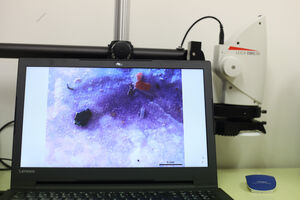 Ângela Pereira foi afetada por aspergilose, uma doença que atinge crianças e jovens