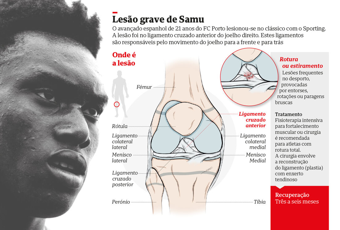 Lesão de Samu