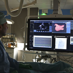 'É uma questão de urgência de saúde pública”, alertam médicos sobre atrasos na cirurgia cardíaca no Norte