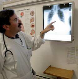 Portugal registou número de casos de tuberculose mais baixo de sempre