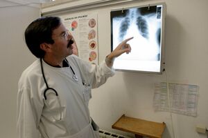 Portugal registou número de casos de tuberculose mais baixo de sempre