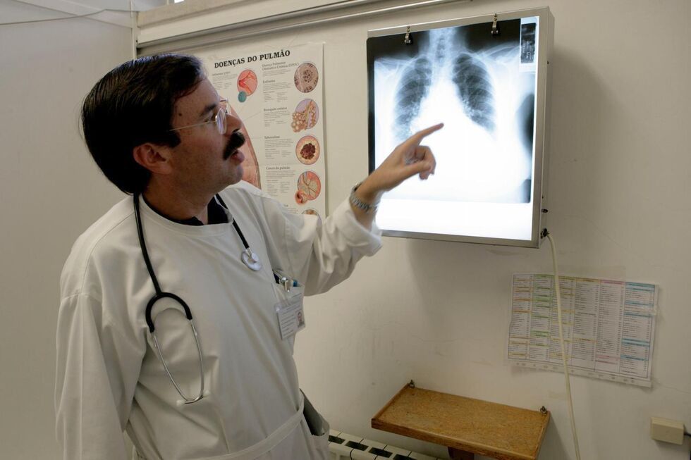 Casos de tuberculose em Portugal têm vindo a diminuir