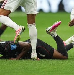 Arrepiante: Koné (Canadá) fraturou a perna após lance com jogador do Qatar