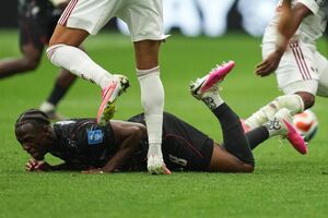 Koné com a perna fraturada