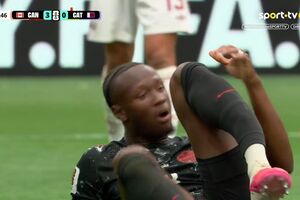 Koné com a perna fraturada