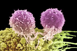  Em Portugal há, anualmente, cerca de 1.500 novos casos de melanoma, o tipo de cancro de pele mais grave e agressivo