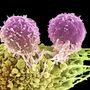 Vacina contra o melanoma: o entusiasmo justifica-se? 