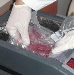 Corações transplantados que ficam mais novos? 'Vamos poder usar dadores mais velhos'