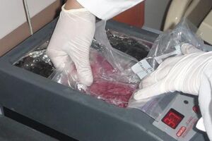 Corações transplantados ajustam-se à idade do recetor